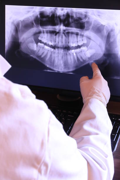 Best Knocked-Out Tooth Emergency  in Mi Wuk Village, CA